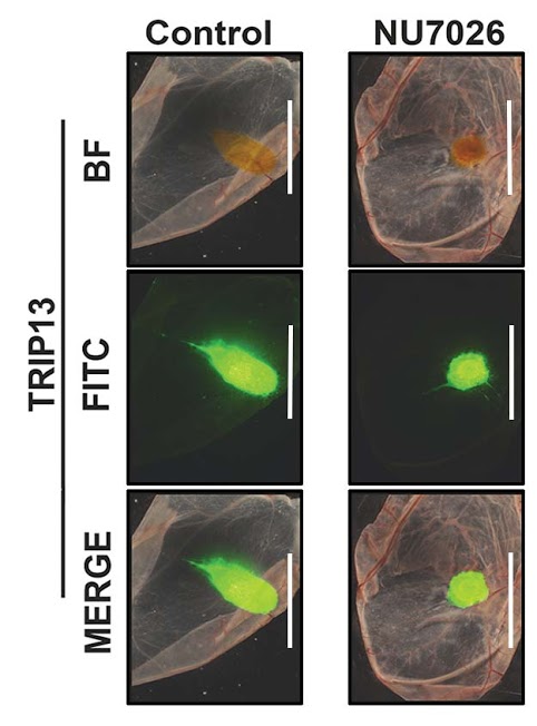 (Left column) Untreated head and neck cancer cells are tagged fluorescent green. (Right column) Shows cells treated with the chemical inhibitor that blocks TRIP13, which results in a dramatically smaller tumor. Image credit: Rajat Banerjee
