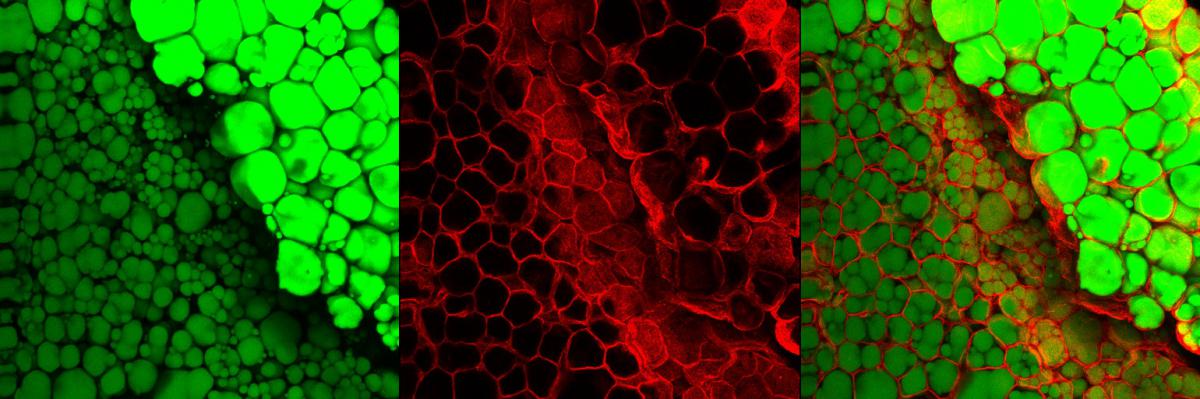 These are fat tissues stained with an antibody marking the boundary of fat cells (red) and a dye staining lipid droplets (green). The cells with large lipid droplets are white fat cells whereas those containing several smaller ones are brown fat cells. Image credit: Guo-Xiao Wang