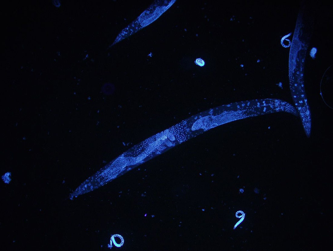 Microscope image of a C. elegans roundworm by HoPo via Wikimedia Commons.