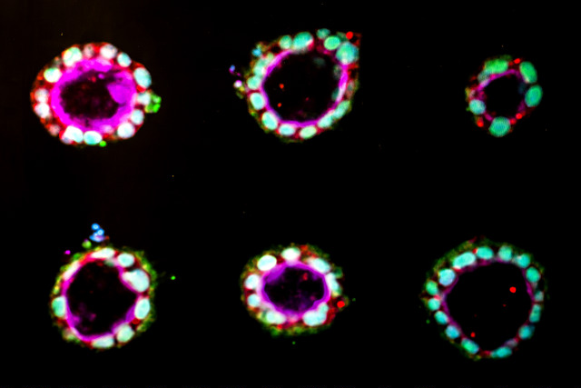Research groups have collaborated to create an experiment in which embryonic stem cells form the beginning of the amniotic sac – the protective membrane around a developing baby. Up until now, the only way to produce this tissue in a lab was to grow a whole embryo. Image credit: Joseph Xu