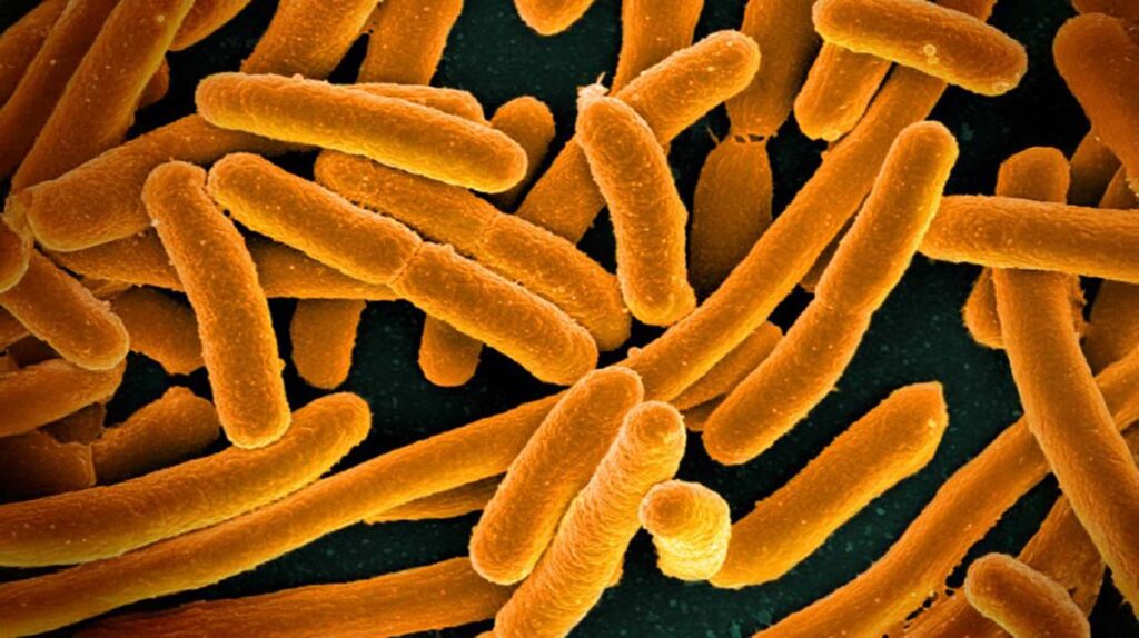 A cluster of E. coli bacterial cells appear as orange rod-shaped structures in a colorized micrograph. Image credit: National Institutes of Health (CC BY-NC 2.0)