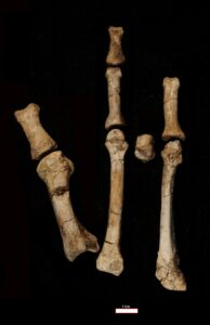 The Burtele foot with its elements in the anatomical position. Image Credit: Yohannes Haile-Selassie