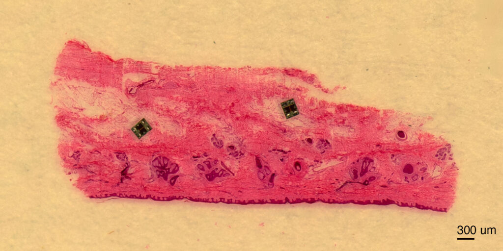 Microrobots over a cross section of skin tissue. At this small size, robots become comparable to many structures in microbiology ranging from a single-celled paramecium to plant cells, to waterbears. Image credit: Maya Lassiter, University of Pennsylvania