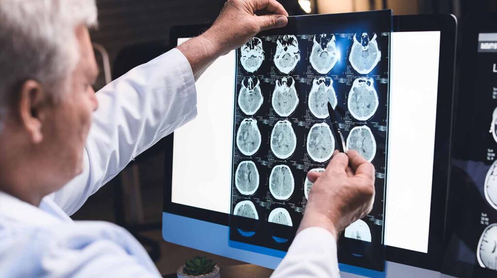 A neurologist evaluates an MRI scan of human head in clinic. Image credit: Adobe Stock